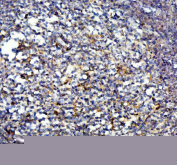 Human IL-10 Antibody Appendix IHC. Immunohistochemistry staining of FFPE human appendix tissue with human IL-10 antibody, HRP-labeled secondary and DAB substrate. HIER: boil tissue sections in pH8 EDTA for 20 min and allow to cool before testing.