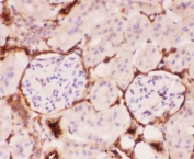 IHC-P: P Glycoprotein antibody testing of mouse kidney tissue. HIER: steam section in pH6 citrate buffer for 20 min.