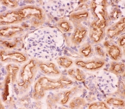 IHC-P: P Glycoprotein antibody testing of rat kidney tissue. HIER: steam section in pH6 citrate buffer for 20 min.
