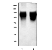 Western blot of 1) rat skeletal muscle and 2) mouse skeletal muscle lysates probed with an ATP2A1 (SERCA1) antibody. A strong, broad band is detected at ~110 kDa in both tissues. The unusually thick band reflects SERCA1âs extremely high abundance and known tendency to migrate as a broad species due to its large transmembrane structure, partial oligomerization, and oxidative/post-translational modification states.