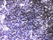 IHC-P: ATP2A3 antibody testing of mouse thymus tissue