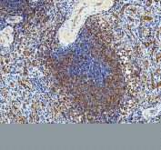 Immunohistochemical staining of FFPE human tonsil tissue with PKC delta antibody, HRP-secondary and DAB substrate. HIER: boil tissue sections in pH8 EDTA for 20 min and allow to cool before testing.