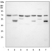 Western blot analysis using HGF antibody. Lane 1: human hepatocellular carcinoma tumor tissue (HCCT) lysates; Lane 2: human hepatocellular carcinoma paracancerous tissue (HCCP) lysates; Lane 3: human HepG2 whole cell lysates; Lane 4: human HUH7 whole cell lysates; Lane 5: rat liver tissue lysates; Lane 6: rat RH35 whole cell lysates; Lane 7: mouse liver tissue lysates. Predicted molecular weight of the HGF single-chain precursor is ~83 kDa. A predominant band is observed at ~70 kDa, consistent with proteolytic processing of HGF to the active form, with additional bands around ~50 kDa and or ~60 kDa in some samples consistent with heterogeneous processing and glycosylation-dependent mobility shifts.