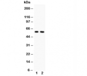 Alkaline Phosphatase Antibody Tissue Non-Specific WB. Western blot testing of Alkaline Phosphatase antibody and Lane 1:  rat heart;  2: rat brain.  Predicted molecular weight ~57 kDa, but can be observed at up to ~75 kDa due to glycosylation.