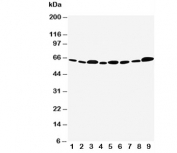 Western blot testing of Apoptosis Inhibitor 5 antibody and Lane 1:  rat heart;  2: rat brain;  3: rat testis;  4: rat placenta;  5: human MCF-7;  6: human HeLa;  7: human CEM;  8: human SMMC-7721;  9: human COLO320 cell lysate. Predicted molecular weight ~59 kDa.