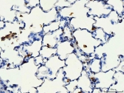 CD44 Antibody Rat Lung IHC. Immunohistochemistry analysis of CD44 / CD44 antigen expression in FFPE rat lung tissue using antibody. Membranous HRP-DAB brown staining is observed in scattered epithelial and interstitial cells, highlighting cell surface localization consistent with CD44 expression. The staining pattern demonstrates regional distribution across alveolar structures and supports its use for evaluating CD44 expression and cellular organization in lung tissue. Heat induced epitope retrieval was performed by boiling tissue sections in pH 8 EDTA for 20 min followed by cooling before testing.