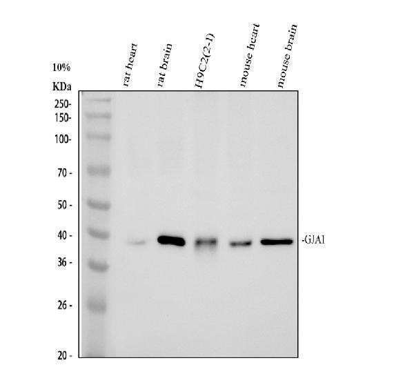 Connexin 43 Antibody Mouse and Rat WB. Western blot testing of 1) rat heart, 2) rat brain, 3) rat H9C2 cardiomyoblast cells, 4) mouse heart, and 5) mouse brain lysates with Connexin 43 antibody at 0.5 ug/ml. A distinct immunoreactive band is detected at approximately 43 kDa in each sample, consistent with the predicted molecular weight of Connexin 43. The results demonstrate specific detection of this gap junction protein, which forms intercellular channels that mediate electrical and metabolic coupling between neighboring cells and are essential for synchronized cardiac function and neuronal communication.