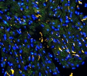 Connexin 43 Antibody Rat Heart IF. Immunofluorescent staining of FFPE rat heart tissue with Connexin 43 antibody (green) at 1 ug/ml. Heat-induced epitope retrieval (HIER) was performed by boiling tissue sections in pH 6, 10 mM citrate buffer for 10â20 minutes and allowing them to cool prior to staining. Nuclei are counterstained with DAPI (blue). Connexin 43 immunoreactivity is observed in a punctate distribution along cardiomyocyte cell borders, consistent with the expected localization of this gap junction protein that forms intercellular channels essential for electrical coupling and coordinated cardiac contraction.