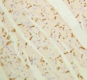 Connexin 43 Antibody Rat Heart IHC. Immunohistochemical staining of FFPE rat heart tissue with Connexin 43 antibody at 1 ug/ml. Heat-induced epitope retrieval (HIER) was performed by boiling tissue sections in pH 6, 10 mM citrate buffer for 10â20 minutes and allowing them to cool prior to staining. Connexin 43 immunoreactivity is observed in a punctate pattern at cardiomyocyte cell borders, consistent with the expected localization of this gap junction protein that forms intercellular channels essential for electrical coupling and synchronized cardiac contraction. Cell nuclei are counterstained with hematoxylin (blue).