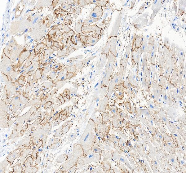 Connexin 43 Antibody Human Cardiomyocyte IHC. Immunohistochemical staining of FFPE human heart tissue with Connexin 43 antibody at 2 ug/ml. Heat-induced epitope retrieval (HIER) was performed by boiling tissue sections in pH 8 EDTA buffer prior to staining. Connexin 43 immunoreactivity is observed in a punctate pattern along cardiomyocyte cell borders, consistent with the expected localization of this gap junction protein that forms intercellular channels responsible for electrical coupling and coordinated myocardial contraction. Cell nuclei are counterstained with hematoxylin (blue).