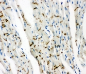 Cx43 Antibody Rat Heart Gap Junction IHC. Immunohistochemical staining of FFPE rat heart tissue with Cx43 antibody. Cx43 immunoreactivity is observed in a characteristic punctate pattern along cardiomyocyte cell borders, consistent with the expected localization of this gap junction protein that forms intercellular channels essential for electrical coupling and synchronized cardiac contraction. Cell nuclei are counterstained with hematoxylin (blue).