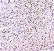 Cx43 Antibody Rat Heart Electrical Coupling IHC. Immunohistochemical staining of FFPE rat heart tissue with Cx43 antibody at 1 ug/ml. Heat-induced epitope retrieval (HIER) was performed by steaming tissue sections in pH 6 citrate buffer for 20 minutes and allowing them to cool prior to staining. Cx43 immunoreactivity is observed in a punctate pattern along cardiomyocyte cell borders, consistent with the expected localization of this gap junction protein that mediates electrical coupling, intercellular communication, and synchronized cardiac contraction. Cell nuclei are counterstained with hematoxylin (blue).