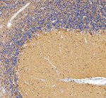 GAD67 Antibody Human Cerebellum IHC. Immunohistochemistry analysis of FFPE human cerebellum tissue using GAD67 Antibody. Heat induced antigen retrieval was performed in pH 8.0 EDTA buffer prior to overnight incubation with primary antibody (2 ug/mL) at 4Â°C. Peroxidase-conjugated goat anti-rabbit IgG and DAB chromogen were used for visualization. Strong cytoplasmic staining is observed throughout the cerebellar cortex, highlighting GABAergic neurons consistent with the expression of GAD67 (glutamate decarboxylase 67), the enzyme responsible for gamma-aminobutyric acid (GABA) synthesis. These results support the use of GAD67 Antibody for studying GAD67 expression, GABAergic neurotransmission and inhibitory neuronal biology.