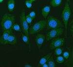 GAD67 Antibody Rodent Brain WB. Western blot analysis using GAD67 Antibody. Lane 1: rat brain tissue lysate; Lane 2: mouse brain tissue lysate. A specific band is detected at approximately 67 kDa in both samples, consistent with the expected molecular weight of GAD67 (GAD1). The strong expression observed in rodent brain tissue is consistent with the abundant presence of GAD67 in GABAergic neurons, where it catalyzes the conversion of glutamate to gamma-aminobutyric acid (GABA). These results support the use of GAD67 Antibody for studying GAD67 expression, GABA synthesis and inhibitory neurotransmission.