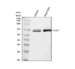GAD67 Antibody SiHa Cell IF. Immunofluorescence analysis of SiHa cells using GAD67 Antibody. Cells were treated with enzyme antigen retrieval reagent for 15 minutes prior to blocking with goat serum and overnight incubation with primary antibody (5 ug/mL) at 4Â°C. Fluoro488-conjugated secondary antibody was used for detection, and DAPI (blue) was used as a nuclear counterstain. Diffuse cytoplasmic staining is observed throughout the cells, consistent with the intracellular localization of GAD67 (glutamate decarboxylase 67), the enzyme responsible for gamma-aminobutyric acid (GABA) synthesis. These results support the use of GAD67 Antibody for studying GAD67 expression, GABA biosynthesis and neuronal marker biology.