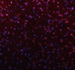 Lamin B1 Antibody Rat Brain IF. Immunofluorescent staining of FFPE rat brain tissue with Lamin B1 Antibody at 5 ug/ml. HIER was performed using pH 8 EDTA buffer, followed by blocking with 10% goat serum. The tissue section was incubated with rabbit anti-Lamin B1 antibody overnight at 4Â°C, followed by Cy3 conjugated goat anti-rabbit IgG secondary antibody (red). Nuclei were counterstained with DAPI (blue). Lamin B1 Antibody / Nuclear Envelope Marker Antibody demonstrates nuclear envelope staining consistent with LMNB1 localization and supports studies of nuclear lamina organization, nuclear architecture and chromatin-associated cellular regulation pathways.