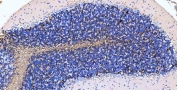IHC-P: MBP antibody testing of rat cerebellum tissue. HIER: boil tissue sections in pH8 EDTA buffer for 10-20 min and allow to cool before testing.