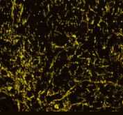 IHC staining of rat brain tissue with MBP antibody (yellow), HRP secondary and TSA 570 reagent. HIER: boil tissue sections in pH8 EDTA buffer for 10-20 min and allow to cool before testing.