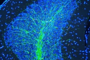 Immunofluorescent staining of FFPE rat brain with MBP antibody (green) at 2ug/ml and DAPI nuclear stain (blue). HIER: steam section in pH6 citrate buffer for 20 min.