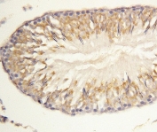 IHC-P: Morg1 antibody testing of rat lung tissue