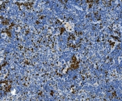 Myeloperoxidase Antibody Mouse Spleen IHC. Immunohistochemistry staining of FFPE mouse spleen tissue with Myeloperoxidase antibody. HIER: boil tissue sections in pH8 EDTA for 20 min and allow to cool before testing.