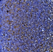 Myeloperoxidase Antibody Rat Lymph Tissue IHC. Immunohistochemistry staining of FFPE rat lymph tissue with Myeloperoxidase antibody. HIER: boil tissue sections in pH8 EDTA for 20 min and allow to cool before testing.