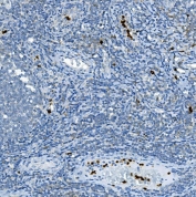 Myeloperoxidase Antibody Tonsil Tissue IHC. Immunohistochemistry staining of FFPE human tonsil tissue with Myeloperoxidase antibody. HIER: boil tissue sections in pH8 EDTA for 20 min and allow to cool before testing.