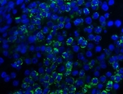 Myeloperoxidase Antibody for IF / MPO Immunofluorescence Antibody. Immunofluorescence analysis of Myeloperoxidase / MPO in FFPE human spleen tissue using Myeloperoxidase Antibody for IF. Bright granular cytoplasmic fluorescence (green) highlights MPO-positive myeloid cells within the splenic tissue, while nuclei are counterstained with DAPI (blue). Heat-induced epitope retrieval was performed by steaming sections in pH8 EDTA buffer for 20 minutes prior to staining.