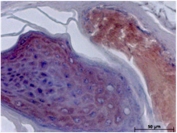 NSE Antibody Mouse Skin IHC. Immunohistochemistry testing of FFPE mouse skin with NSE antibody. Additional testing information can be found in Schmidt, Anke, et al. One Year Follow-Up Risk Assessment in SKH-1 Mice and Wounds Treated with an Argon Plasma Jet. International Journal of Molecular Sciences 18.4 (2017): 868.