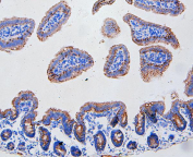 CD95 Antibody Mouse Intestine IHC. Immunohistochemistry analysis of CD95 / FAS antibody in mouse intestine tissue Paraffin-embedded mouse intestine section shows membranous and cytoplasmic brown chromogenic staining in intestinal epithelial cells, consistent with CD95 expression, while nuclei remain blue. Heat-mediated antigen retrieval was performed in citrate buffer (pH6). Tissue sections were blocked with 10% goat serum and incubated with rabbit anti-FAS antibody overnight at 4oC, followed by biotinylated goat anti-rabbit IgG secondary antibody incubation for 30 minutes at 37oC.