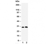 Aquaporin 5 Antibody Rat Lung and Testis WB. Western blot testing of Aquaporin 5 antibody and Lane 1:  rat lung;  2: rat testis tissue lysate. Predicted molecular weight ~28 kDa.