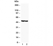 Western blot testing of GFAP antibody and Lane 1. rat brain,  2: mouse brain tissue lysate. Predicted molecular weight: ~50 kDa.