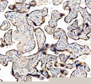 Immunohistochemistry analysis of TFPI2 / Tissue factor pathway inhibitor 2 antibody in human placental tissue. Formalin-fixed, paraffin-embedded placenta demonstrates extracellular and pericellular HRP-DAB brown staining outlining chorionic villi and trophoblastic structures, consistent with matrix-associated TFPI2 expression. Hematoxylin counterstain highlights nuclei and villous architecture. Heat-induced epitope retrieval was performed by boiling tissue sections in pH 8 EDTA for 20 minutes followed by cooling prior to staining.
