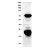 Western blot analysis of TFPI2 in human placenta lysate. The TFPI2 antibody detects a strong band at approximately 27â30 kDa, consistent with the reported glycosylated forms of tissue factor pathway inhibitor 2 (TFPI2), together with a prominent band at approximately 70 kDa. Similar higher molecular weight TFPI2-reactive species have been described in extracellular matrix fractions and likely represent dimeric or matrix-associated forms of TFPI2 rather than non-specific background.