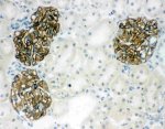 Podocin Antibody Rat Kidney Glomerulus IHC. Immunohistochemistry staining of frozen rat kidney tissue was performed with Podocin Antibody at 1 ug/ml overnight at 4oC. Biotinylated goat anti-rabbit IgG and streptavidin-biotin complex with DAB were used for detection. Strong podocin staining is localized to the renal glomeruli, with minimal staining in the surrounding tubular tissue. This Podocin Antibody demonstrates the characteristic glomerular distribution of NPHS2 and supports its use as a glomerular podocyte marker.