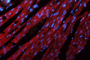 Immunofluorescent staining of FFPE rat heart tissue with N-Cadherin antibody (red) and DAPI nuclear stain (blue). HIER: steam section in pH8 EDTA for 20 min.