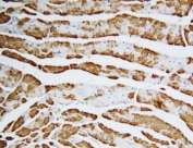 FABP3 Antibody Rat Heart IHC. Immunohistochemistry staining of FFPE rat heart with FABP3 antibody. HIER: boil tissue sections in pH6, 10mM citrate buffer, for 20 min and allow to cool before testing.