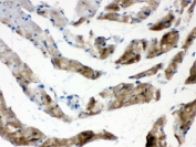 FABP3 Antibody FFPE Rat Heart Tissue IHC. Immunohistochemistry staining of FFPE rat heart with FABP3 antibody. HIER: boil tissue sections in pH6, 10mM citrate buffer, for 20 min and allow to cool before testing.