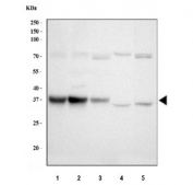 HSD11B1 Antibody Liver WB. Western blot testing of 1) human HCCT, 2) human HCCP, 3) monkey liver, 4) rat liver and 5) mouse liver tissue lysate with HSD11B1 antibody. Predicted molecular weight: ~32 kDa.
