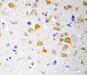 5HT2A Receptor / HTR2A Antibody Rat Brain IHC. Immunohistochemical staining of FFPE rat brain tissue using 5HT2A Receptor / HTR2A Antibody. An HRP-conjugated secondary antibody with DAB substrate was used for detection. 5HT2A Receptor / HTR2A Antibody, recognizing the serotonin receptor HTR2A, demonstrates predominantly neuronal cytoplasmic and membranous staining in rat brain tissue, consistent with the expected distribution of HTR2A within the central nervous system.