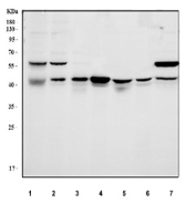 Western blot analysis using NDRG1 antibody. Lane 1: human HeLa whole cell lysate; Lane 2: human 293T whole cell lysate; Lane 3: human A431 whole cell lysate; Lane 4: human PC-3 whole cell lysate; Lane 5: rat brain tissue lysate; Lane 6: rat PC-12 whole cell lysate; Lane 7: mouse brain tissue lysate. NDRG1 antibody detects a major band at approximately 43 kDa, consistent with the predicted molecular weight of N-myc downstream regulated gene 1. An additional band at approximately 55-60 kDa is observed in some samples and is consistent with post-translationally modified forms of NDRG1.