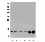 Galectin Antibody Human Cell Line WB. Western blot analysis of 1) human HeLa, 2) human MCF7, 3) human COLO-320, 4) human A549, 5) human 22RV1, and 6) human A375 cell lysates using Galectin antibody. A distinct immunoreactive band is detected at approximately 14 kDa across all six cell lines, consistent with the expected molecular weight of Galectin-1 (LGALS1). Signal intensity varies between cell types, with stronger expression observed in 22RV1 and A375 cells. Galectin-1 is a beta-galactoside-binding lectin involved in immune regulation, cell adhesion, apoptosis, angiogenesis, and glycan-mediated signaling pathways. The results support the utility of the Galectin antibody for western blot detection of endogenous Galectin-1 expression in diverse human cancer cell lines. Predicted molecular weight: ~14 kDa.