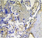 Galectin Antibody Human Placenta IHC. Immunohistochemical staining of frozen human placenta tissue using Galectin antibody demonstrates membranous and cytoplasmic HRP-DAB brown staining within placental trophoblast-associated cellular structures. The staining pattern is consistent with expression of Galectin-1 (LGALS1), a beta-galactoside-binding lectin involved in cell adhesion, immune tolerance, extracellular matrix interactions, and maternal-fetal communication. Galectin-1 expression within placental tissues is associated with regulation of trophoblast function, angiogenesis, and immune homeostasis at the maternal-fetal interface. The observed immunoreactivity supports the utility of the Galectin antibody for detection of endogenous Galectin-1 in frozen tissue specimens.