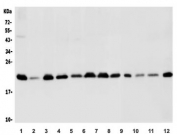 Western blot testing of human 1) PC-3, 2) HEK293, 3) Jurkat, 4) Caco-2, 5) U-2 OS, 6) HepG-2, 7) HeLa, 8) A549, 9) rat heart, 10) rat lung, 11) mouse heart and 12) mouse lung lysate with BAK antibody. Expected molecular weight ~23 kDa.