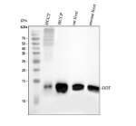 DDT Antibody Human Liver Cancer and Liver WB. Western blot analysis of human hepatocellular carcinoma tumor, human hepatocellular carcinoma paracancerous tissue, rat liver, and mouse liver lysates using DDT Antibody / MIF-2 Antibody. Lane 1: human hepatocellular carcinoma tumor (HCCT); Lane 2: human hepatocellular carcinoma paracancerous tissue (HCCP); Lane 3: rat liver; Lane 4: mouse liver. A specific immunoreactive band is detected at approximately 13 kDa in all samples, consistent with the predicted molecular weight of D-dopachrome tautomerase (MIF-2). The consistent detection across human tumor-associated tissue and rodent liver samples demonstrates cross-species recognition and supports the use of this DDT Antibody for investigating MIF-2 expression, macrophage migration inhibitory factor family signaling, liver biology, and cancer-associated inflammatory responses.