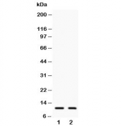 Eotaxin 3 Antibody C Terminus western blot analysis detecting CCL26. Lane 1: human COLO320 lysate, Lane 2: human A549 lysate. A band is detected at approximately 11 kDa, consistent with the predicted molecular weight of Eotaxin-3 / C-C motif chemokine ligand 26 (CCL26). The detected signal corresponds to the small secreted chemokine produced by epithelial and tumor cells, which functions as a CCR3 ligand involved in eosinophil recruitment and type 2 inflammatory signaling pathways.