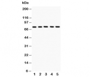 12 Lipoxygenase Antibody Human Cell WB. Western blot testing of 1) human A549, 2) human MCF-7, 3) human COLO320, 4) human Jurkat, and 5) human HeLa cell lysates with 12 Lipoxygenase antibody. A distinct immunoreactive band is detected at approximately 75 kDa in all samples, consistent with the expected molecular weight of 12-Lipoxygenase (ALOX12). The results demonstrate specific detection of this lipid peroxidation enzyme, which catalyzes arachidonic acid metabolism to generate bioactive lipid mediators involved in inflammatory signaling, platelet function, oxidative stress, ferroptosis, and regulation of cellular homeostasis.