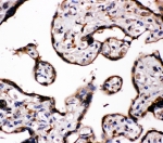 IHC-P: Aromatase antibody testing of human placenta tissue