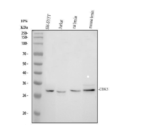 CDK5 Antibody Human and Rodent Brain WB. Western blot testing of 1) human SH-SY5Y, 2) human Jurkat, 3) rat brain, and 4) mouse brain lysates with CDK5 antibody at 0.5 ug/ml. A distinct immunoreactive band is detected at approximately 33 kDa in all samples, consistent with the predicted molecular weight of Cyclin Dependent Kinase 5 (CDK5). The results demonstrate cross-species detection of this neuronal protein kinase, which regulates protein phosphorylation, cytoskeletal organization, neuronal development, synaptic plasticity, and intracellular signaling.