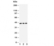 DAPK2 Antibody Human Cell Line WB. Western blot analysis of U87, MCF-7, and SMMC-7721 cell lysates using DAPK2 antibody demonstrates a distinct immunoreactive band at approximately 40-42 kDa in all three samples, consistent with expression of Death Associated Protein Kinase 2 (DAPK2). DAPK2 is a calcium/calmodulin-regulated serine/threonine kinase that functions as an important mediator of apoptosis, cellular stress responses, and intracellular signal transduction pathways. The observed expression across multiple human cell lines supports the utility of this antibody for studies of kinase signaling, programmed cell death regulation, cellular homeostasis, and stress-responsive signaling networks. Predicted molecular weight: ~42 kDa.